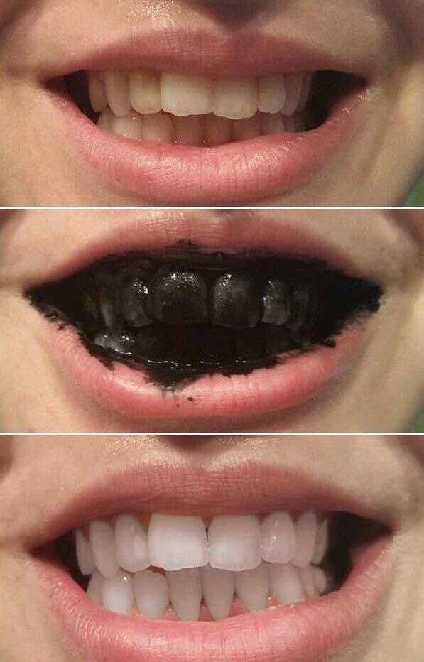 Charcoal Tooth Powder, Natural Teeth Whitening